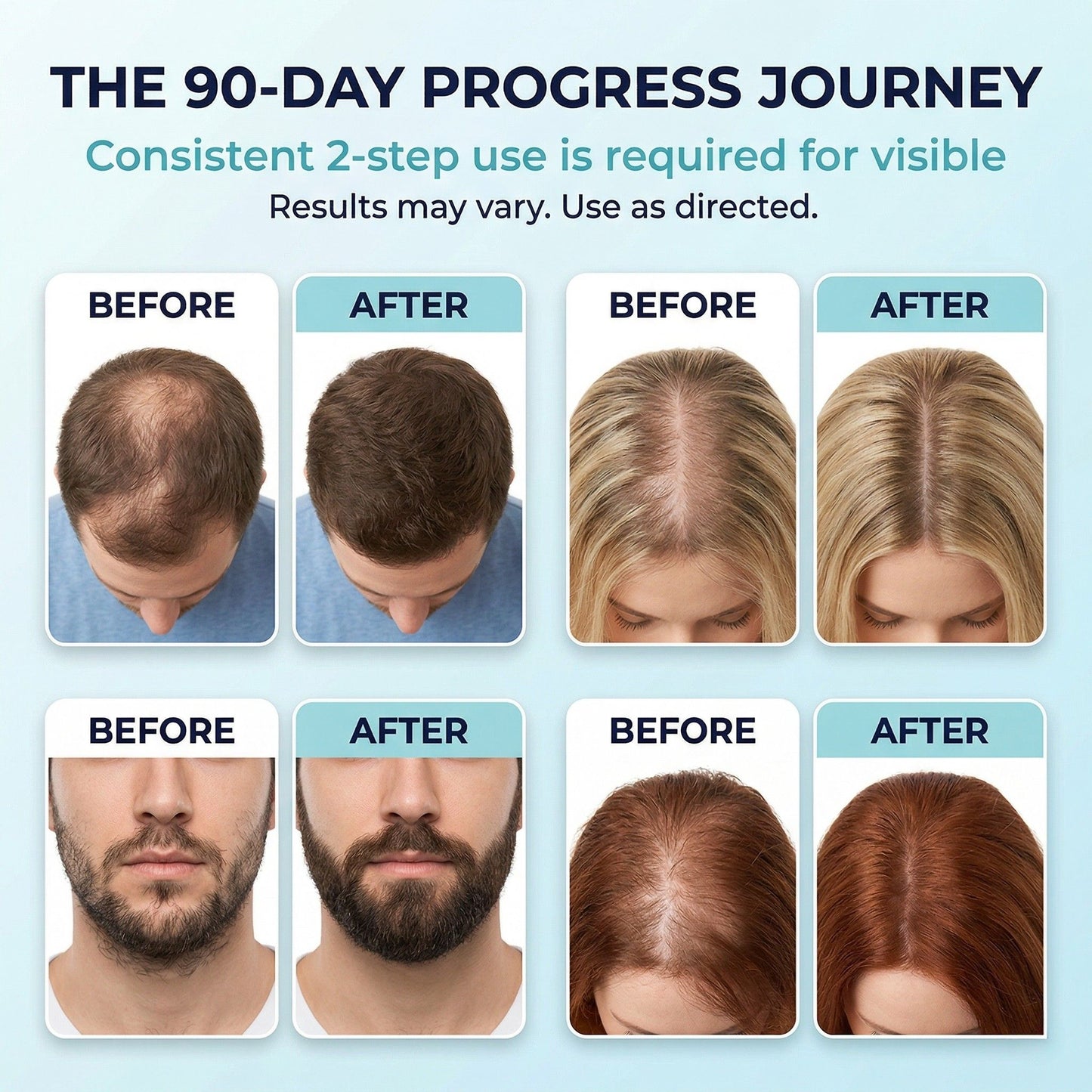 Fiimiu 5% Minoxidil Foam with Biotin – Hair Regrowth Treatment for Men